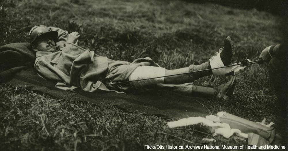 Via Otis Historical Archives National Museum of Health and Medicine