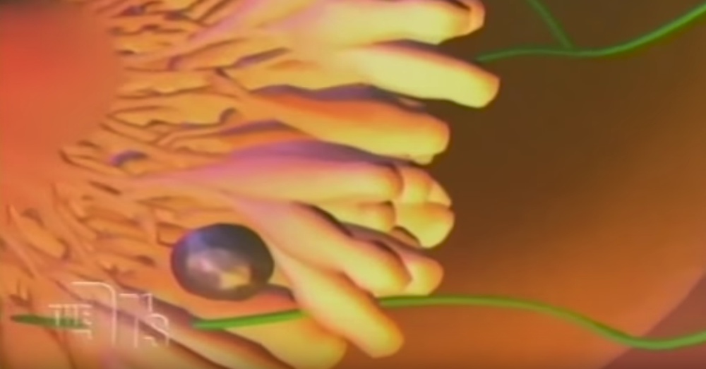 Photo: YouTube/Pink Lotus Breast Center