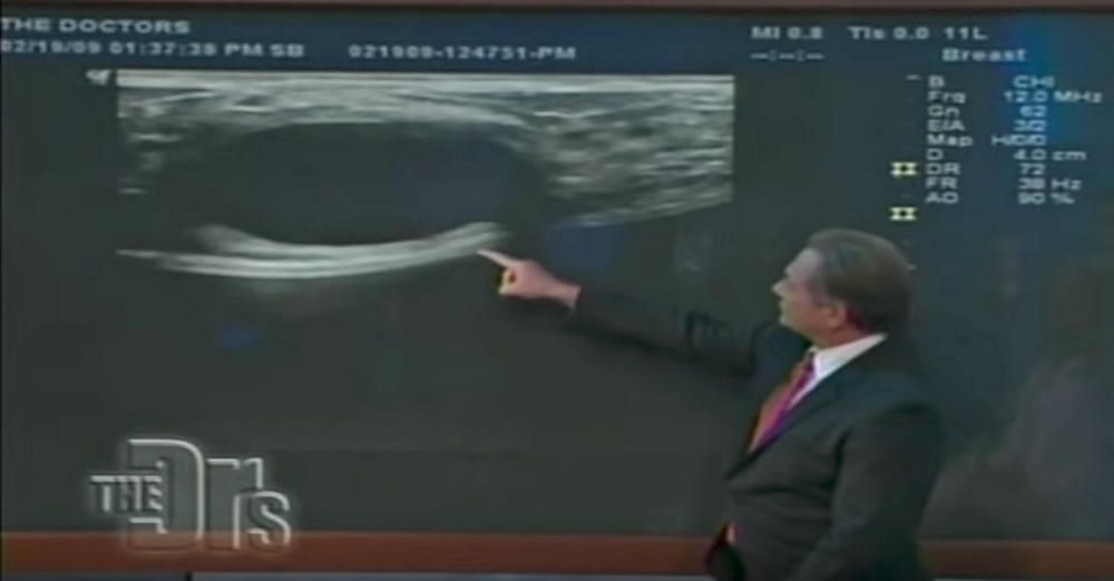 Photo: YouTube/Pink Lotus Breast Center