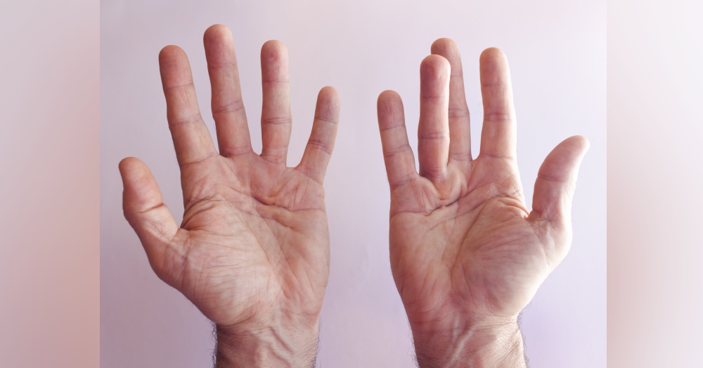 Photo: AdobeStock/perfectmatch
