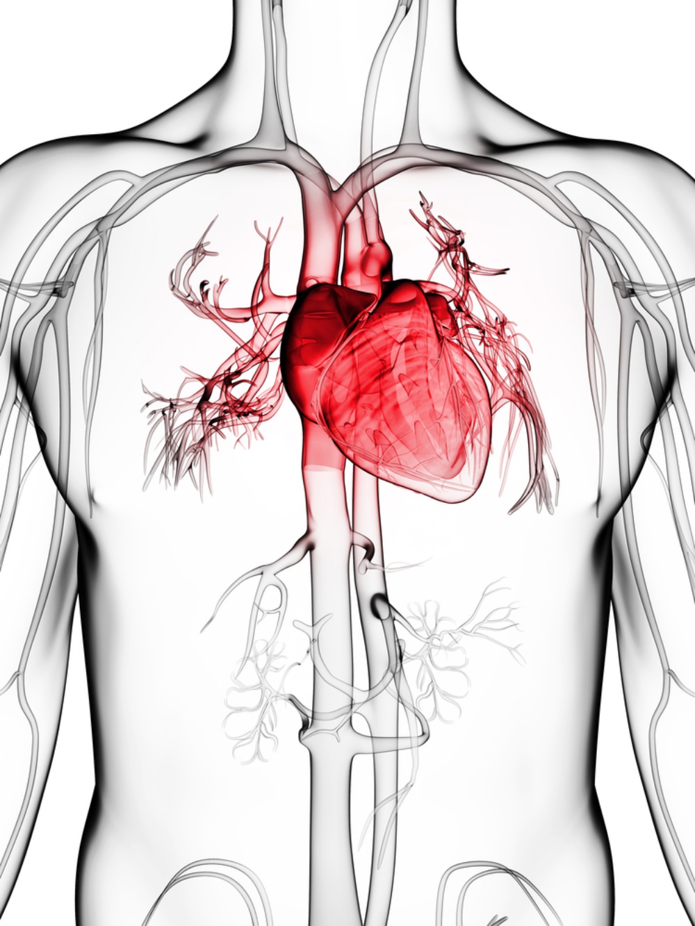 CVD