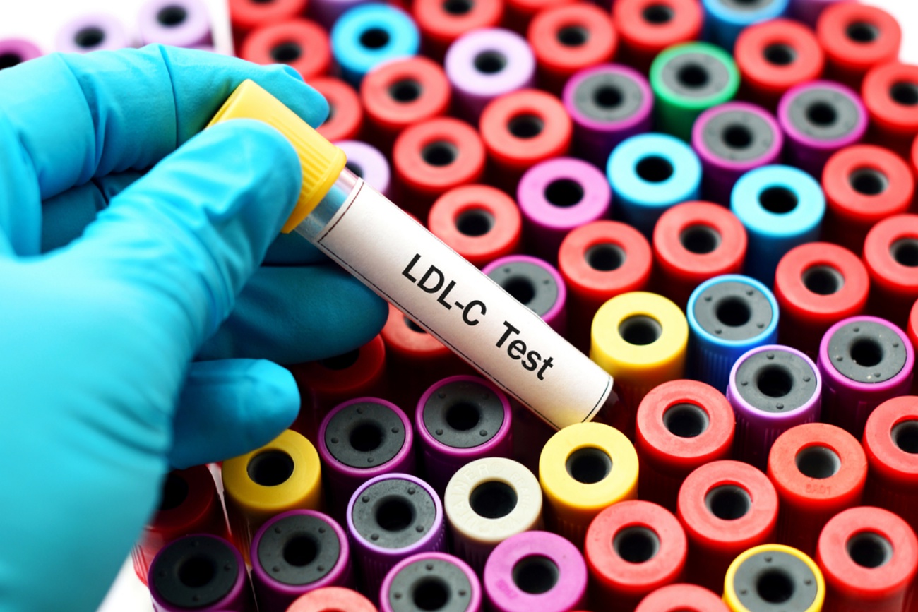LDL